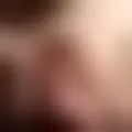Chatta med  sandyrabamaiah80634